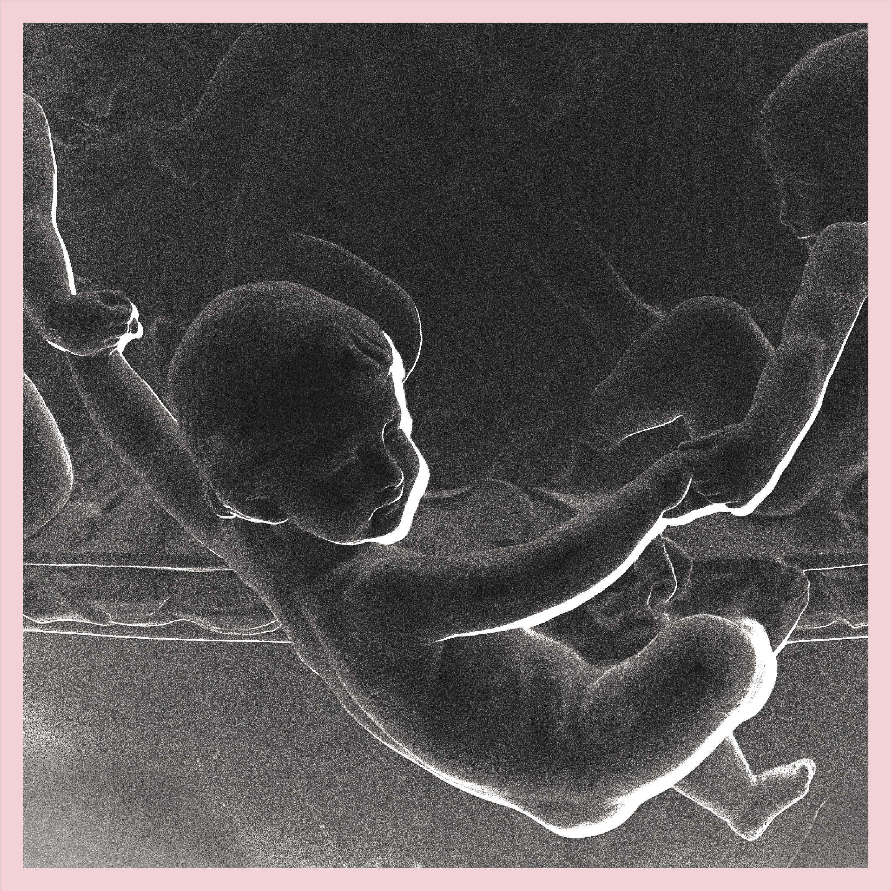 Is It Bad to Put Baby Born Puppies in the Sun? (Pt. 2)