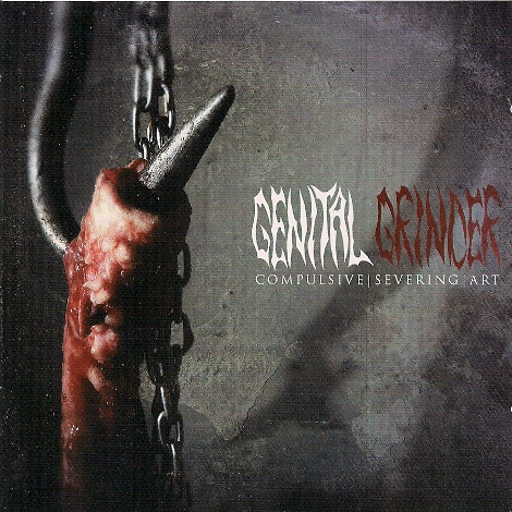 Phlebectomie Des Colaterales Variqueuses Saphenes Avec Conservation Du Tronc