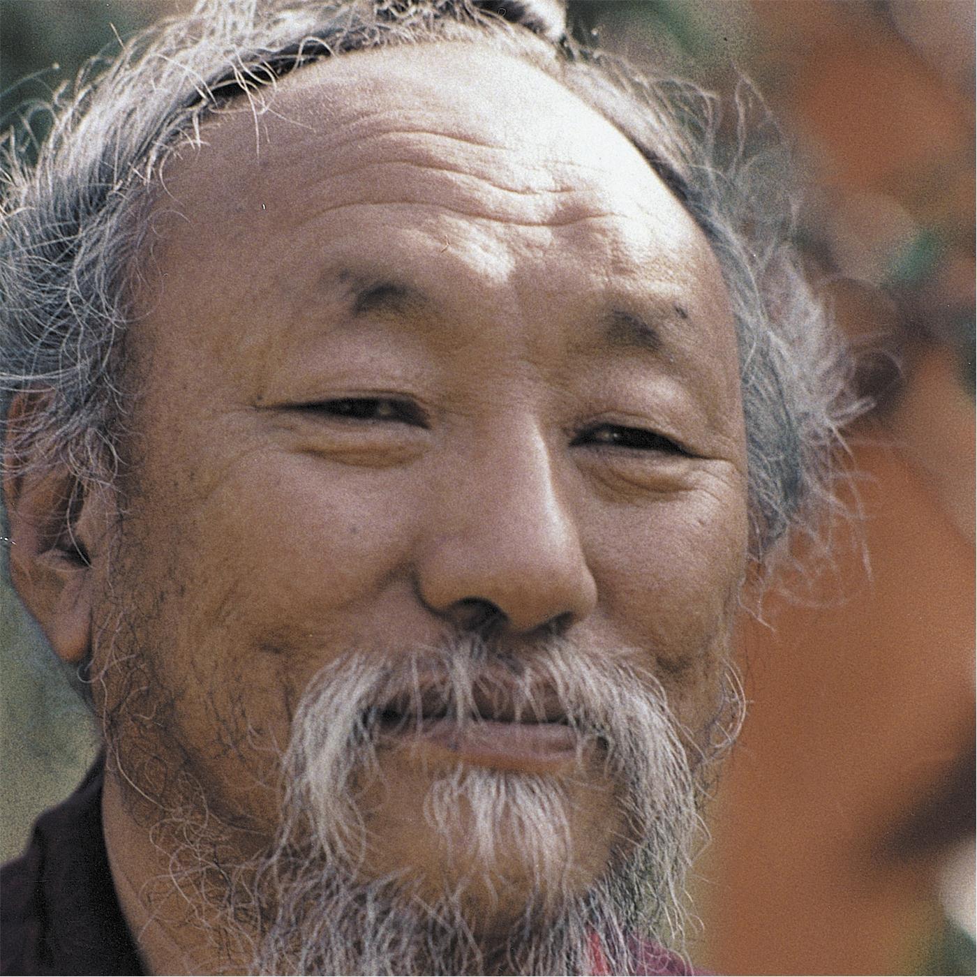 Why Are Your Eyes Yellow