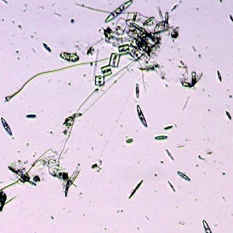 V: licht und schatten wie auf einem bild gleich wird es dunkel