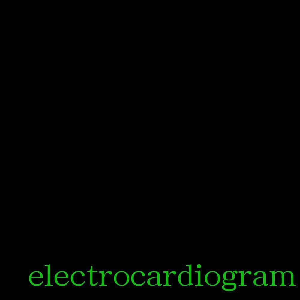 xin yin electrocadiogram ver
