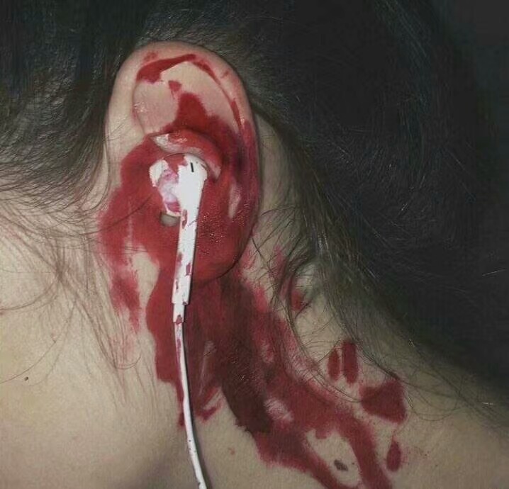 Kaytipkal  hui lai ba