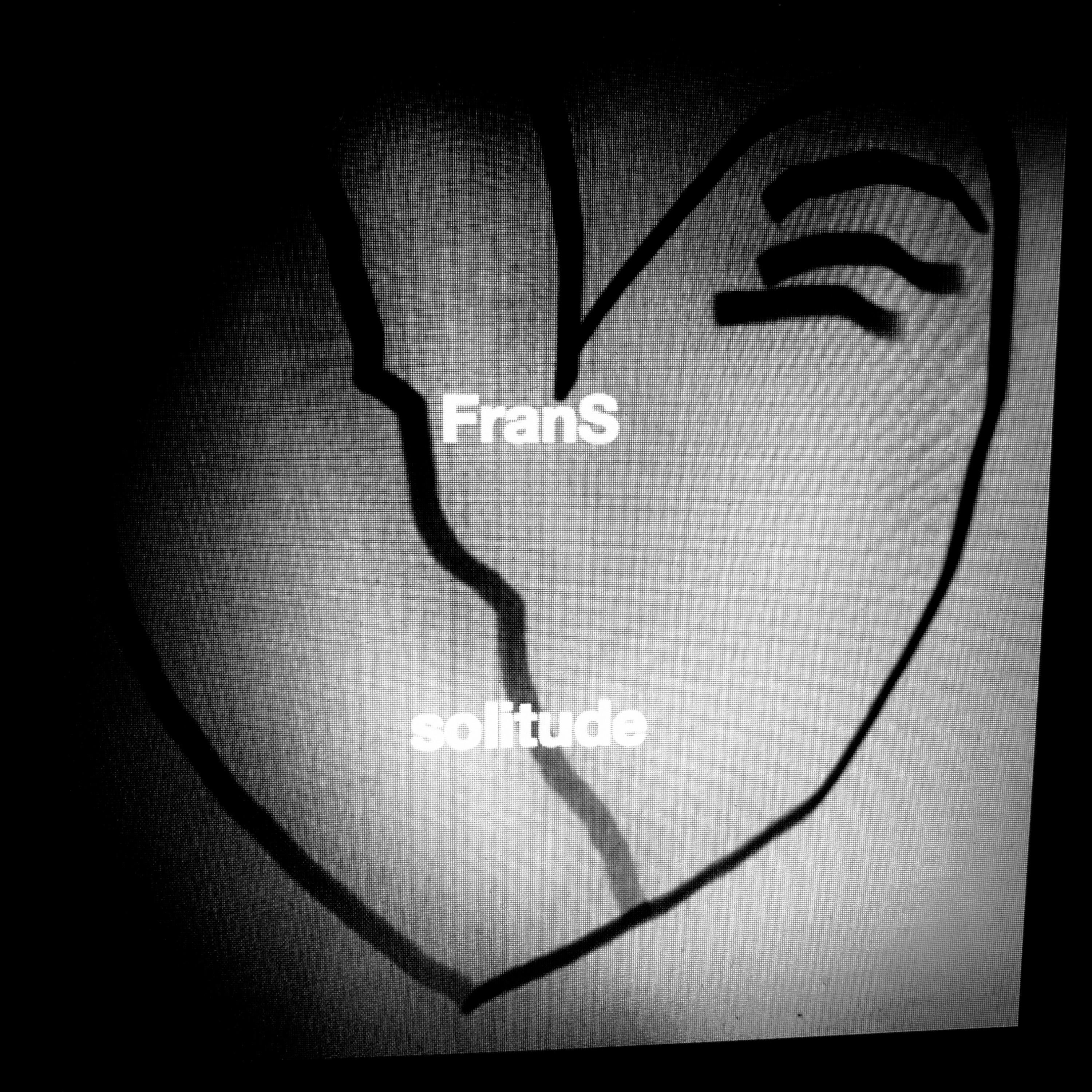 Have You Ever Really Loved