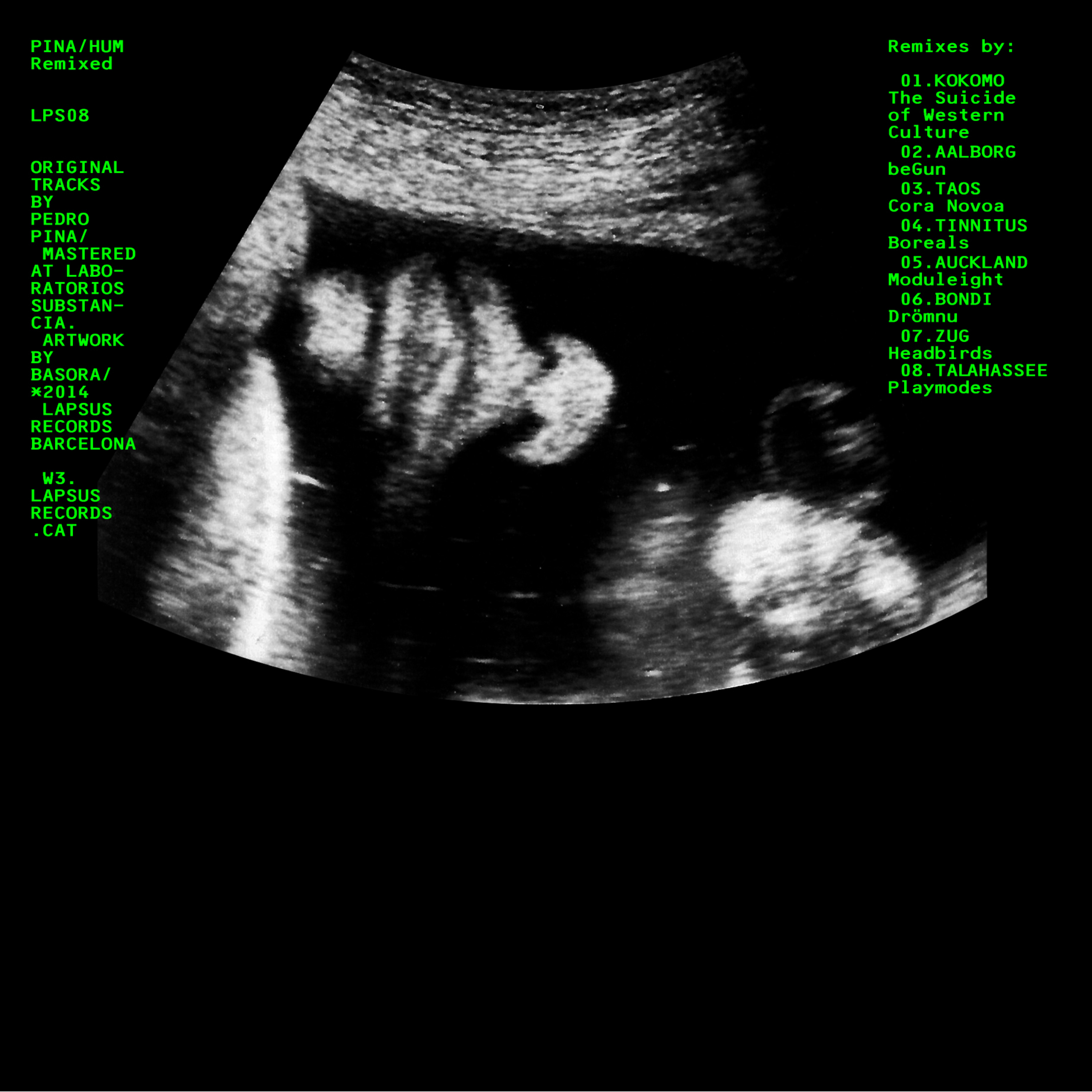 Zug (Headbirds Remix)